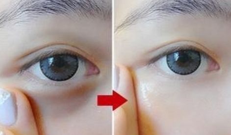 銀川雙眼皮手術(shù)哪家好？推薦2023年最受歡迎的銀川整形醫(yī)院