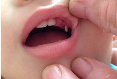 北京哪家醫(yī)院做除皺好？為您推薦北京市專業(yè)除皺醫(yī)院及治療方案