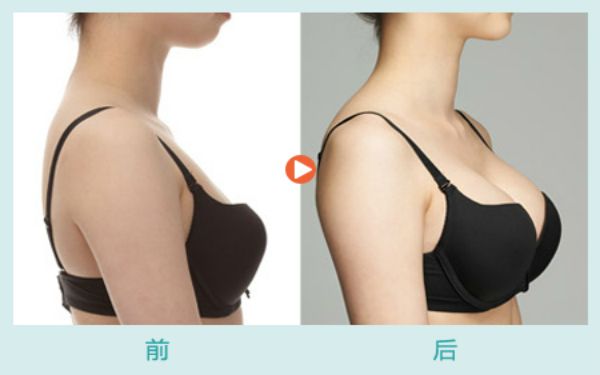 2023年濟(jì)南植發(fā)行業(yè)醫(yī)院對(duì)比，為你揭秘這幾家值得關(guān)注的機(jī)構(gòu)