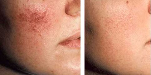 吉林市去疤醫(yī)院排名及評價(jià)，挑選最好的去疤醫(yī)院