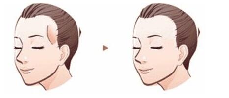 面對超5成大學生脫發(fā)現(xiàn)象，你知道如何自救嗎？