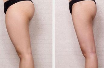 榆林哪家醫(yī)院治療疤痕好？綜合評(píng)估及專家推薦指南