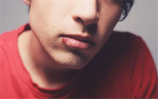 2023廈門很受歡迎的去法令紋手術(shù)美容醫(yī)院排名前十正式公布！