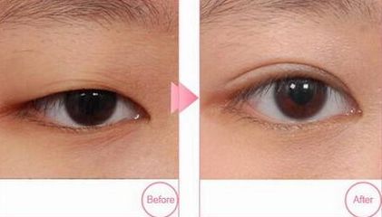 南昌市哪家醫(yī)院的祛痣效果好？排名前三名的醫(yī)院是哪些？