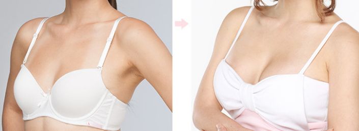 北京隆鼻整形醫(yī)院哪家好？全方位解析推薦與用戶口碑口碑最佳的醫(yī)院