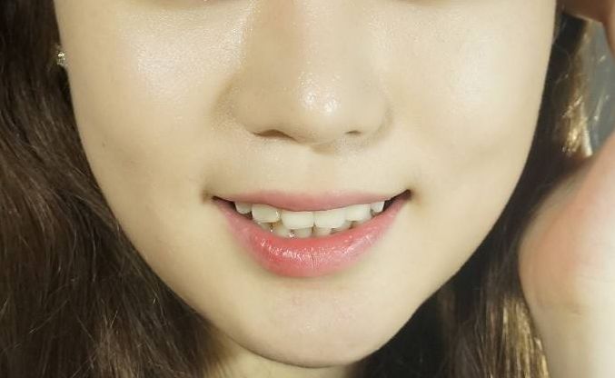 揭秘中國雙眼皮手術(shù)哪家好，專業(yè)醫(yī)院推薦排行榜出爐！