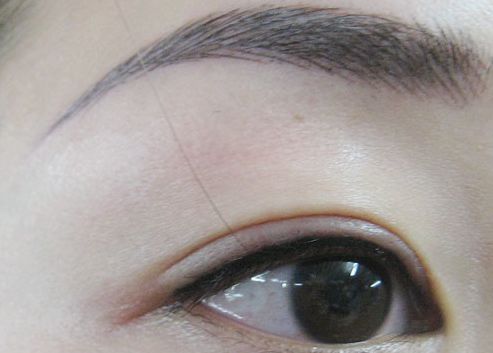 青島哪家醫(yī)院做面部吸脂效果好