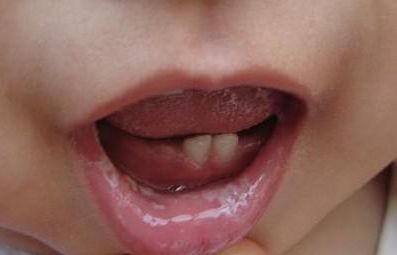 寧波熱瑪吉醫(yī)院哪家好？專業(yè)醫(yī)師團(tuán)隊(duì)、治療效果如何？