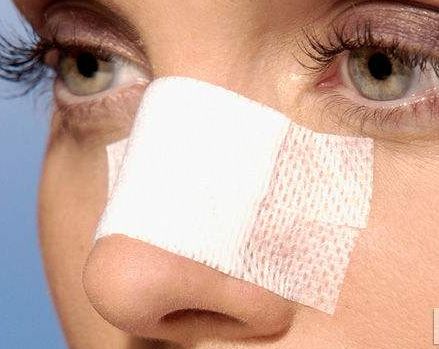 無錫哪家醫(yī)院去皺效果好？TOP醫(yī)院推薦，讓你擁有年輕青春的肌膚！