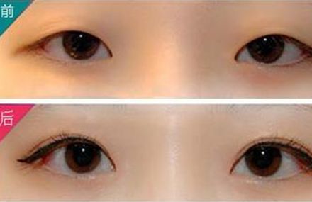 2023廈門美容整形醫(yī)院非常推薦！聲譽(yù)、信譽(yù)、實力俱佳！參考價格表鑒定，體驗更佳！