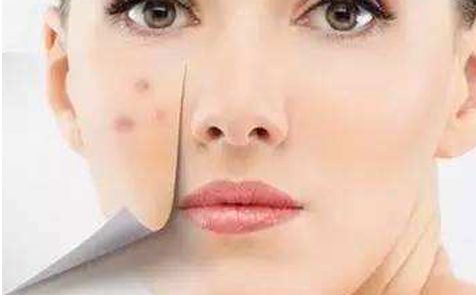 宿遷哪家醫(yī)院的全切雙眼皮技術(shù)好？