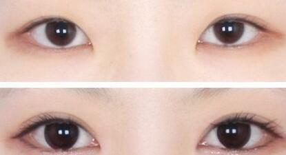 杭州注射式隆鼻整形醫(yī)院排行榜及效果評價，2023年度十佳醫(yī)院盤點！