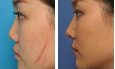 2023年京城哪家醫(yī)院口碑好？推薦北京十大腿部吸脂醫(yī)療整形機(jī)構(gòu)，得人心榜單！