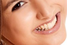 揭秘廈門治療痘疤好的醫(yī)院推薦，專業(yè)解答廈門祛痘坑醫(yī)院哪家好