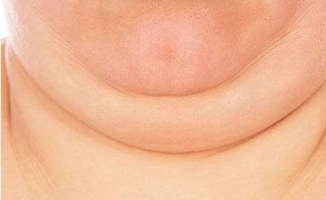 上海植發(fā)行業(yè)權(quán)威排行榜揭曉！哪家醫(yī)院更受贊譽？限時優(yōu)惠等你來！