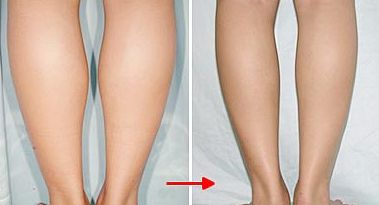 全國眼睛修復(fù)哪家醫(yī)院好？挑選最佳專家進(jìn)行眼睛修復(fù)服務(wù)