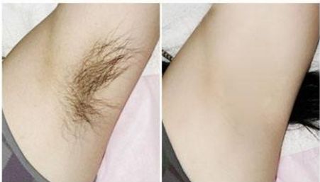 深圳哪家醫(yī)院去色斑好？我們?yōu)槟扑]權(quán)威專家團(tuán)隊(duì)。