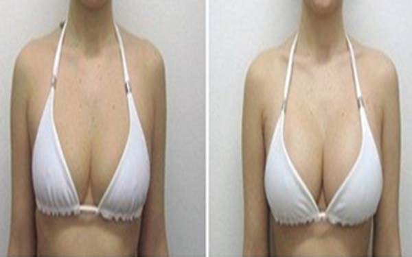 杭州疤痕磨削治療效果好的整形醫(yī)院有哪些？2023年杭州整形醫(yī)院疤痕磨削治療前十強(qiáng)排行揭曉！