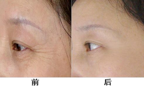 【2023濟(jì)南整形美容醫(yī)院哪家好？排名前十強(qiáng)榜單公布！】