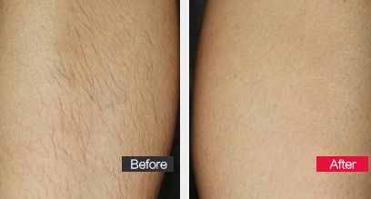 蔡俊濤整容了嗎？揭秘明星整容熱潮中的真相