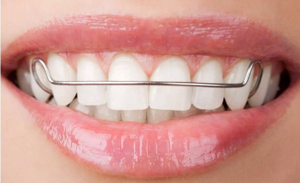 襄陽(yáng)哪家整形醫(yī)院的雙眼皮效果好？