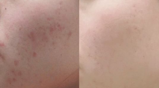 廣州整下巴哪家醫(yī)院好？廣州整下巴的正規(guī)醫(yī)院有哪些？