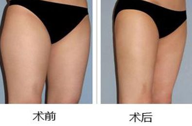 西安市除疤醫(yī)院排名及評價(jià)，哪家好？