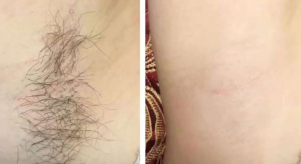 威海鼻部整形醫(yī)院：優(yōu)質(zhì)縮鼻頭機構(gòu)推薦清單