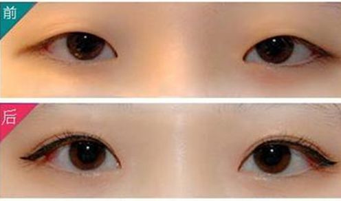 威海哪家正規(guī)激光祛斑機(jī)構(gòu)口碑好？