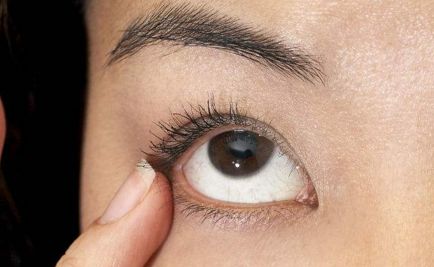 裝臺麗麗的整容手術效果如何？一窺她的美麗變化