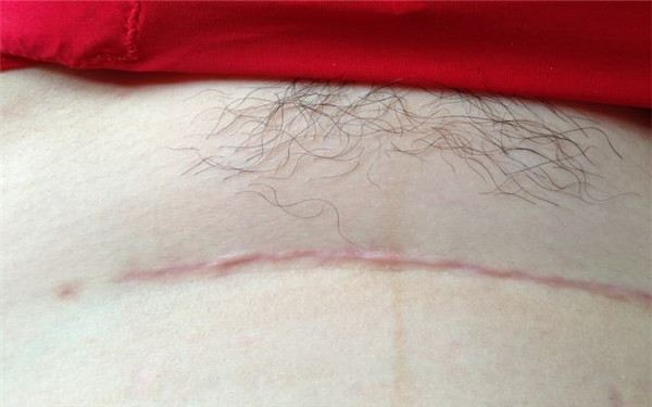 果酸換膚美容時(shí)，有哪些必備產(chǎn)品？