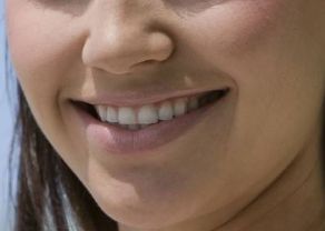 揭秘武漢眼綜合整形醫(yī)院哪家好？專家推薦+患者口碑評價