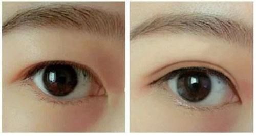 武漢綜合整形醫(yī)院2023年綜合隆鼻排行榜出爐！達(dá)哥拉斯綜合整形醫(yī)院技術(shù)比拼！