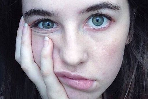 濟南祛斑正規(guī)醫(yī)院排名及評價如何？