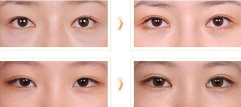 西安醫(yī)院激光祛疤，用戶夸贊不斷！技術(shù)高超，信譽(yù)卓越！