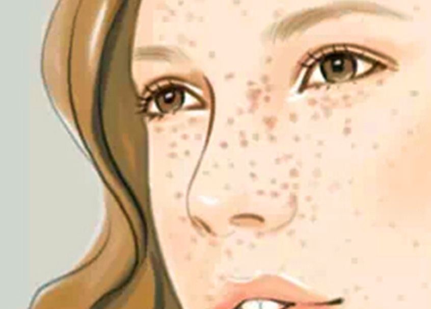 青島雙眼皮整形哪家好？專業(yè)醫(yī)師推薦青島知名整形醫(yī)院排行榜