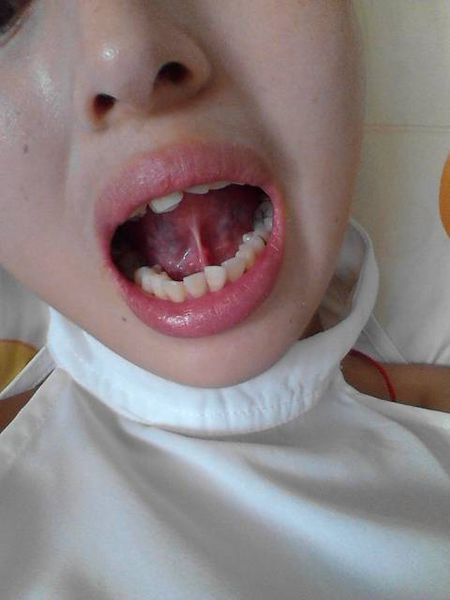 清遠(yuǎn)哪家整形醫(yī)院專(zhuān)業(yè)祛生長(zhǎng)紋效果好？2023年非常受歡迎的激光點(diǎn)陣整容機(jī)構(gòu)推薦！