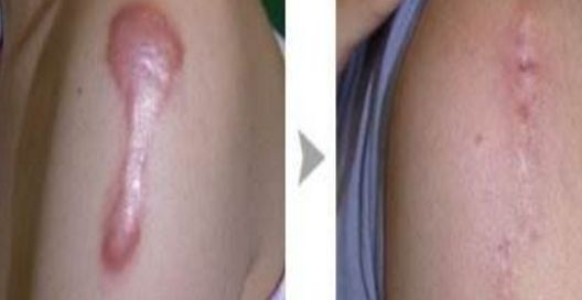 誰來管梁振倫的整容傳聞？現(xiàn)實(shí)與猜測交織