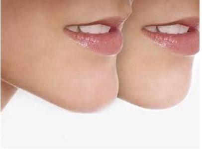 武漢哪家醫(yī)院的美白效果最好？