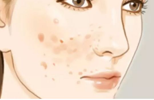 瀘州有哪些專(zhuān)業(yè)祛痘醫(yī)院？推薦你選擇的瀘州祛痘好的醫(yī)院是哪家好？