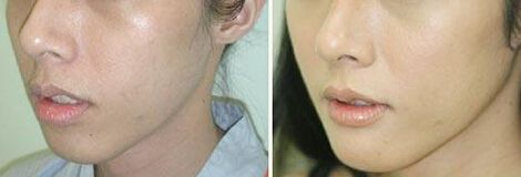 今年流行的減肥藥有哪些？吃過的減肥藥是否存在安全風(fēng)險(xiǎn)？