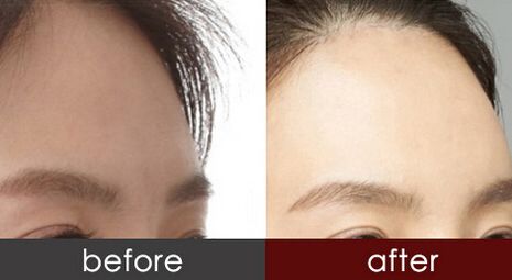 佳木斯整形醫(yī)院哪家好？綜合排名分析揭秘！