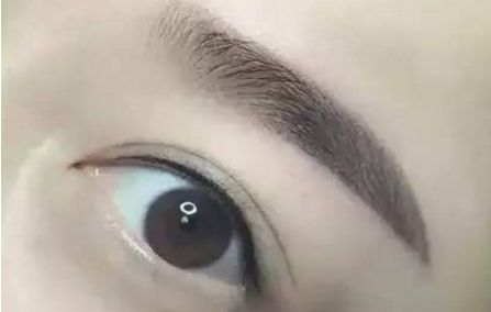 蘇州去除雀斑哪家醫(yī)院好？專業(yè)推薦蘇州市內(nèi)最優(yōu)質(zhì)的雀斑治療醫(yī)院