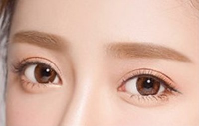 眼部手術中的項目有哪些？眼部手術的費用是多少？