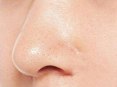 荊州有哪些著名的鼻部脂肪填充醫(yī)院？2023全荊州鼻部脂肪填充醫(yī)院排行榜公布！