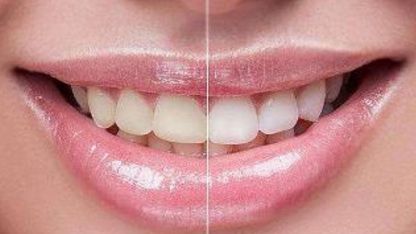 成都乳頭再造術(shù)醫(yī)院排名及費(fèi)用對(duì)比-選擇最適合自己的專業(yè)醫(yī)院