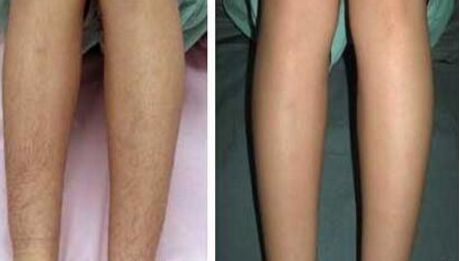 南京哪家下巴整形醫(yī)院好？南京下巴整形醫(yī)院排名前幾位