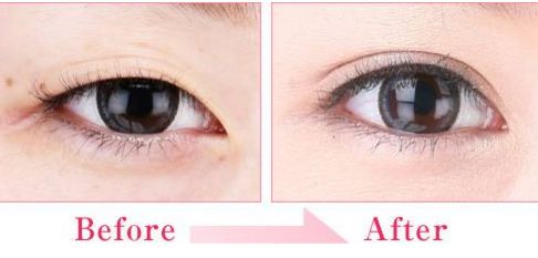 享受專(zhuān)業(yè)整形美容的熱門(mén)去處，廈門(mén)醫(yī)美中心等你來(lái)約