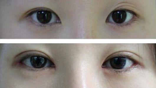 太原除疤效果好的醫(yī)院有哪些？