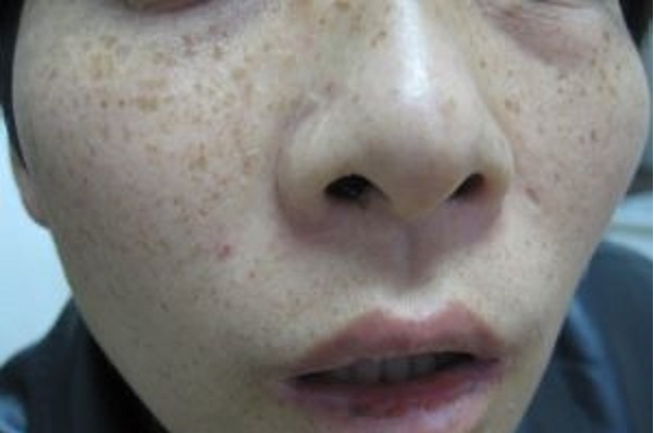 誰是Minana？她是否做過整容手術(shù)？